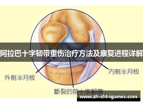 阿拉巴十字韧带重伤治疗方法及康复进程详解